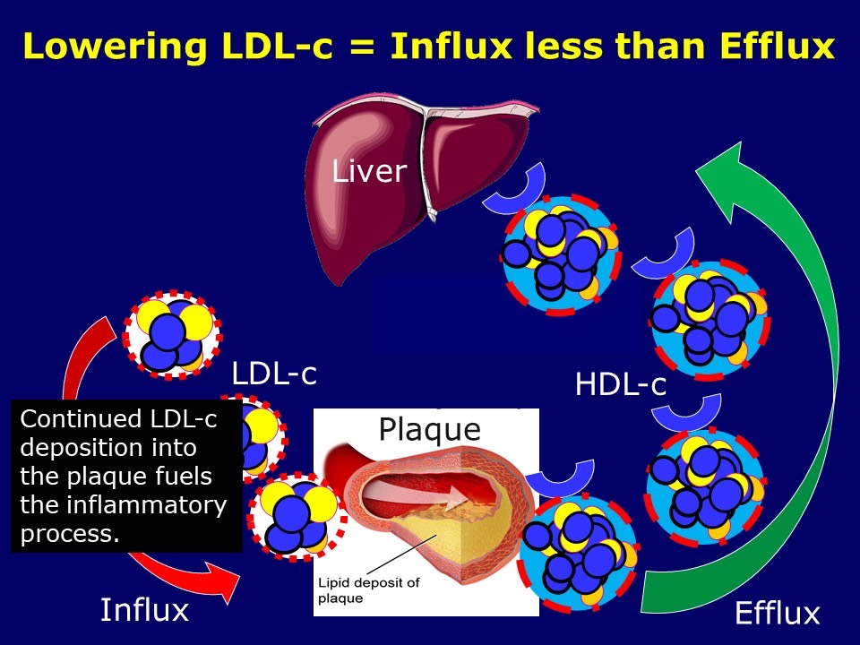 Cholesterol Efflux Greater than Influx