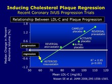 Plaque Regression by Intravascular Ultrasound