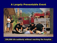 Sudden Cardiac Death - A Common Occurence